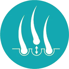 implant-rambut