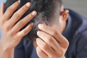 Cara Mengatasi Rambut Rontok Berlebihan: Tips Ampuh untuk Rambut Sehat dan Kuat