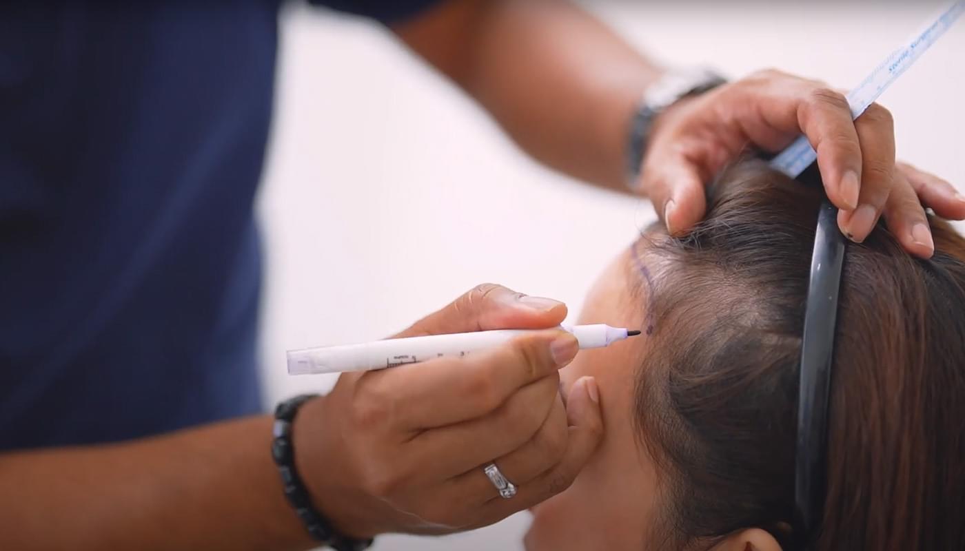 Penyebab Rambut Rontok pada Wanita & Cara Tepat Mengatasinya