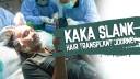 Kaka Slank Hair Transplant